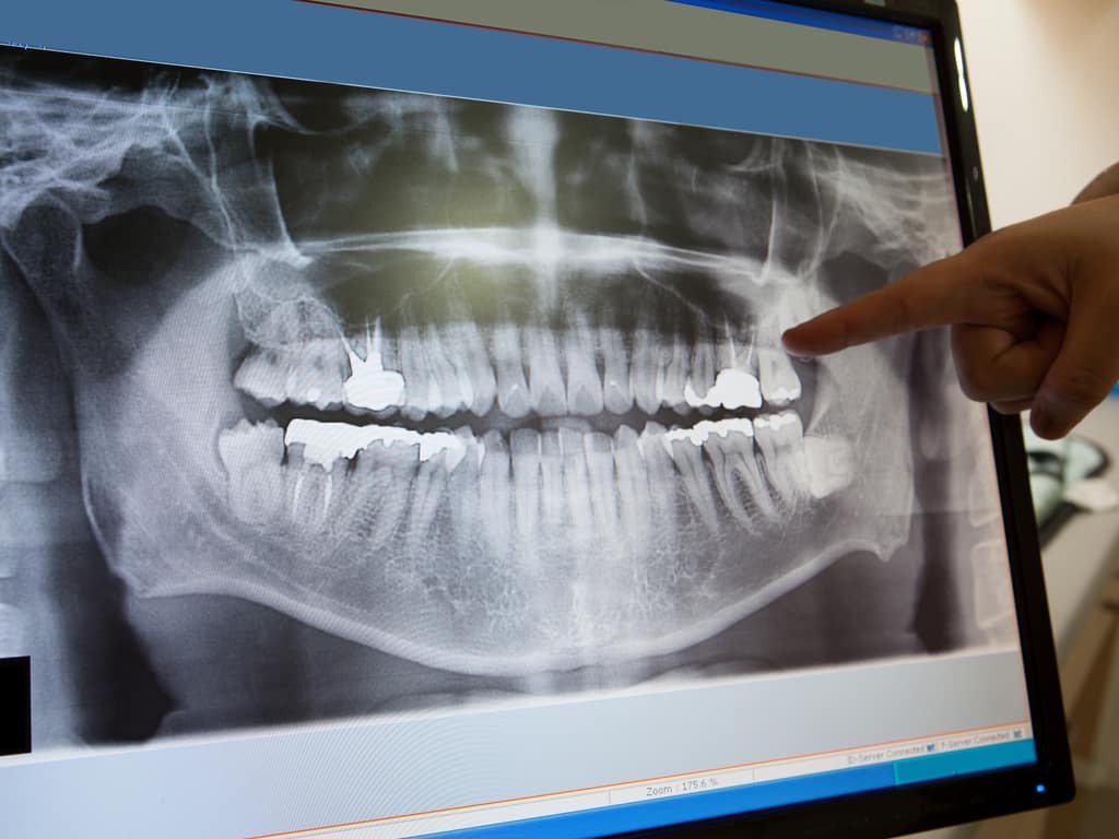Radiographie Numérique