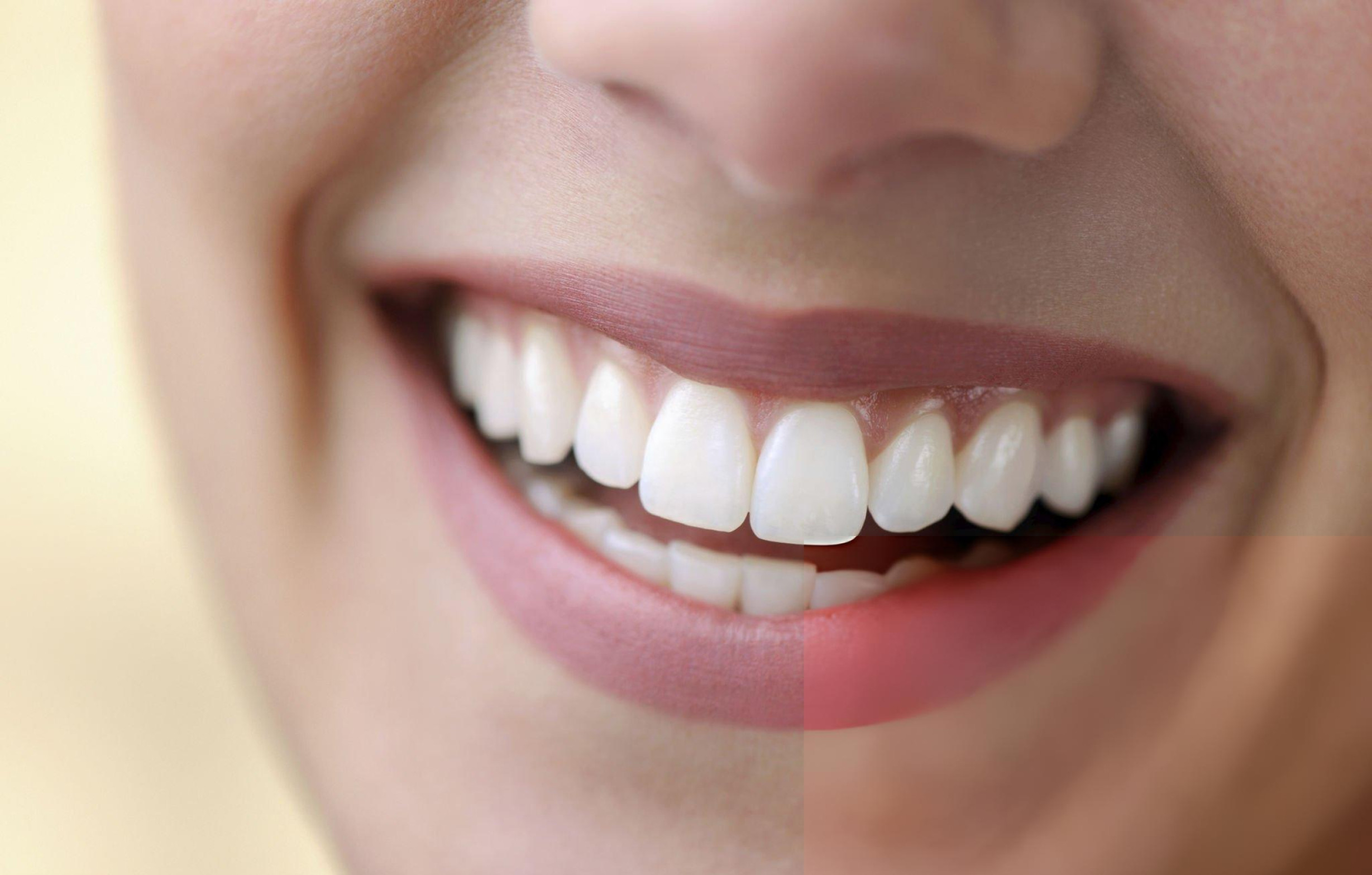 Esthétique Dentaire